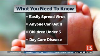 Signs of HFMD