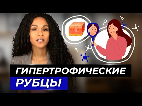 Рубцы: как избавиться? // Методы борьбы с гипертрофическими рубцами // Гипертрофический рубец