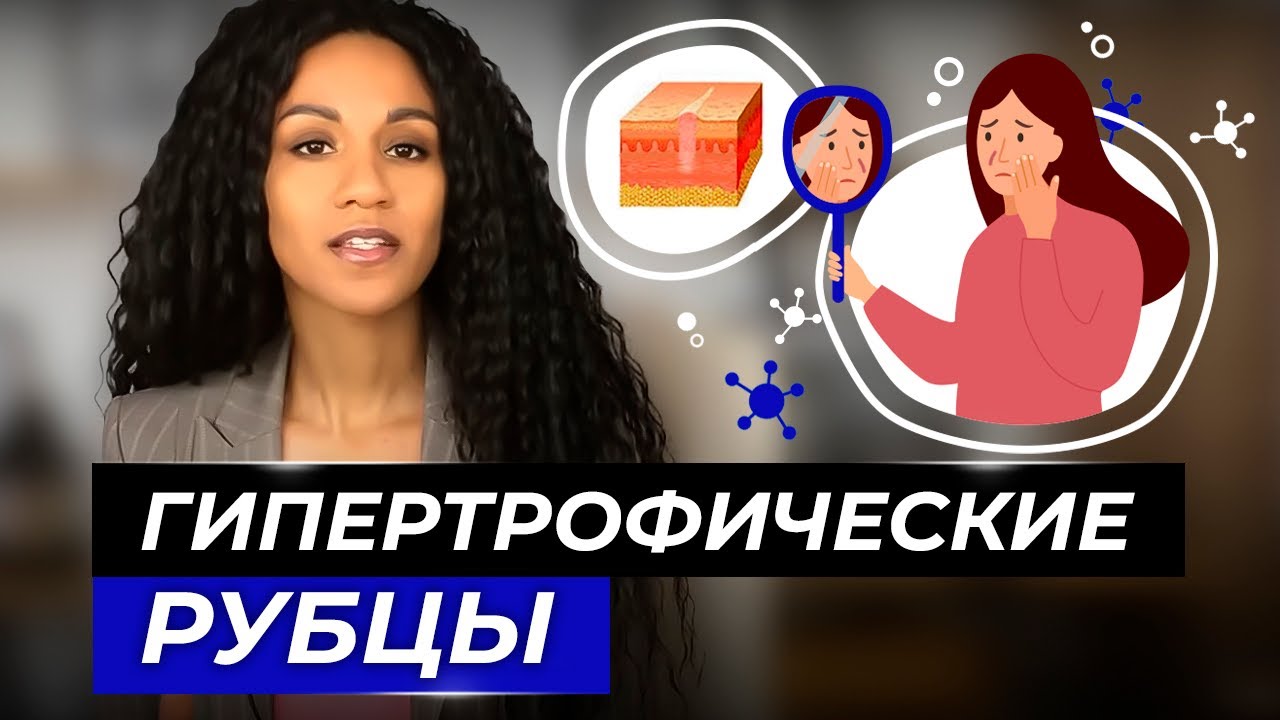 Рубцы: как избавиться? // Методы борьбы с гипертрофическими рубцами // Гипертрофический рубец