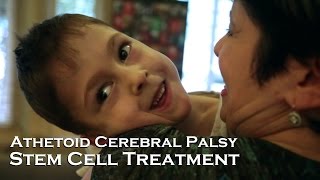 Ashley, Athetoid Cerebral Palsy | Stem Cell Treatment Testimonial