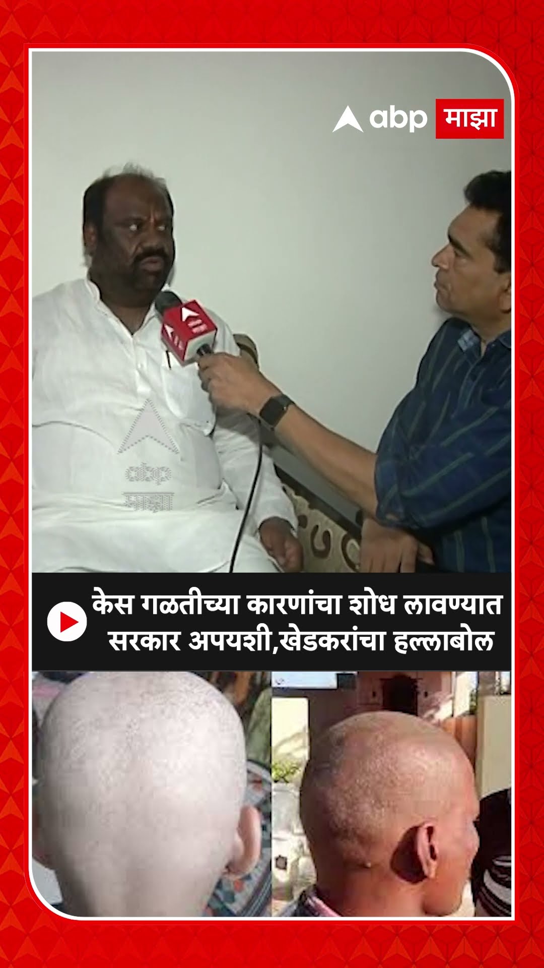 Narendra Khedkar : केस गळतीच्या कारणांचा शोध लावण्यात सरकार अपयशी,खेडकरांचा हल्लाबोल