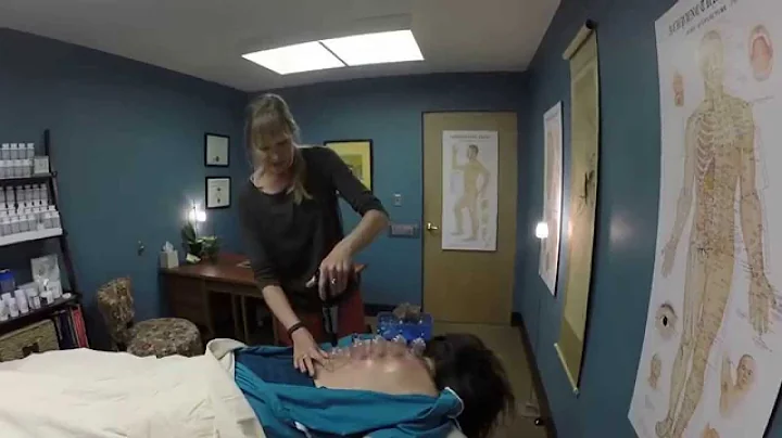 Anne Carruth (LAc) | Cupping in Acupuncture