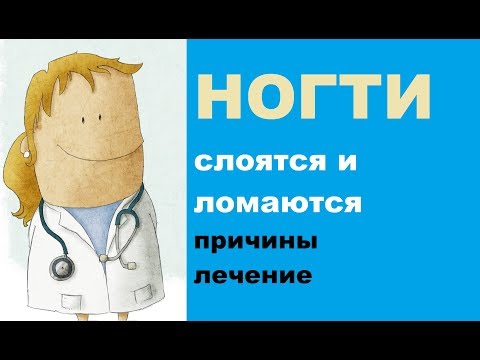 Ногти слоятся и ломаются: причины проблемы и лечение