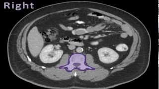 (Precourse) Basic Applications : Aorta - Scanning Technique