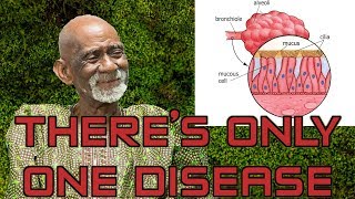 Dr Sebi Reveals Herbs For Mucus Removal