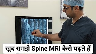 खुद समझे Spine MRI कैसे पढ़ते हैं ( ☎️ +919654095717) screenshot 4