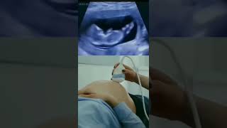 Baby in Mother Womb baby pregnancytips babyboy trendingvideo viral