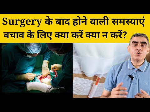 वीडियो: सर्जरी के बाद किसी मित्र का समर्थन करने के 3 तरीके