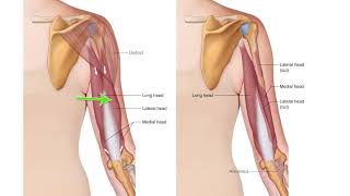 Triceps Brachii   Drawn Figure Attachments   Muscle Anatomy Master Class