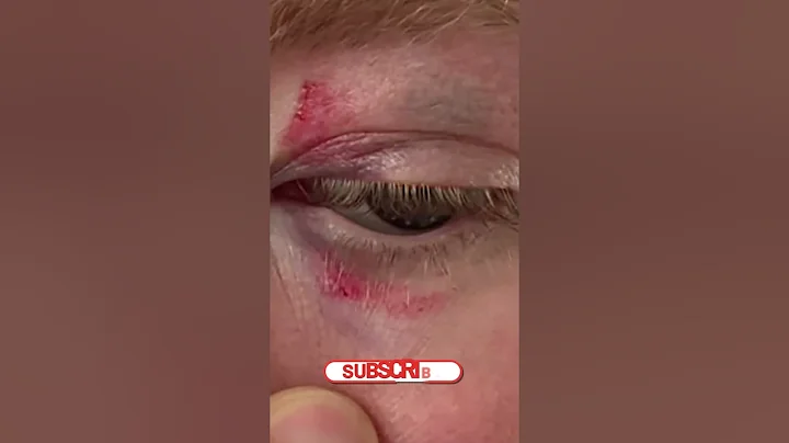 😱 Giant Sturgeon ATTACKS Mermaid Performer – You Won’t Believe This! #mermaidattack, #sturgeonbite