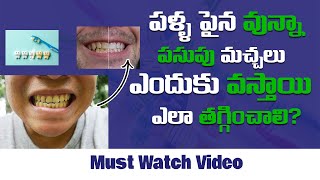 How To Prevent Yellow Spots On Teethes | Telugu Mission Healthy | Unik Life