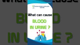 Blood In Urine Dont Ignore These Serious Causes  Dr Gyanendra Singh  Urologist In Lucknow