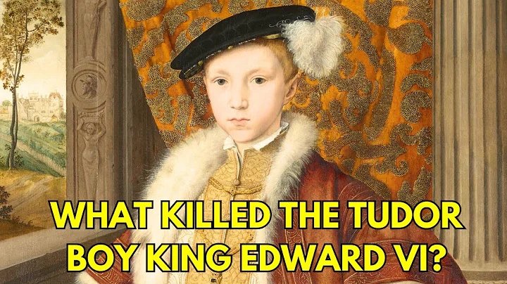 The REAL Cause Of Death Of Edward VI