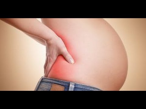 Wideo: Ciąża Rwa Kulszowa: 5 Sposobów Na Złagodzenie Bólu Bez Leków