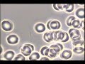 Blood microscopyphase contrast a spirochete