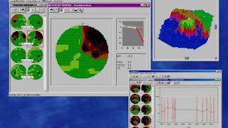 Field progression : which method to use?  part 4 (Progressor) Net Worth
