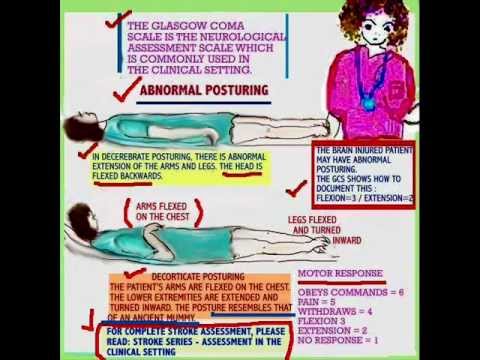 Decorticate And Decerebrate Posturing Which Is Worse Bruin Blog Is Worse Decorticate Or Decerebrate Posturing Pictures To