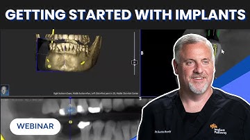 Getting Started with Implants | Predict, Plan, & Place with Confidence