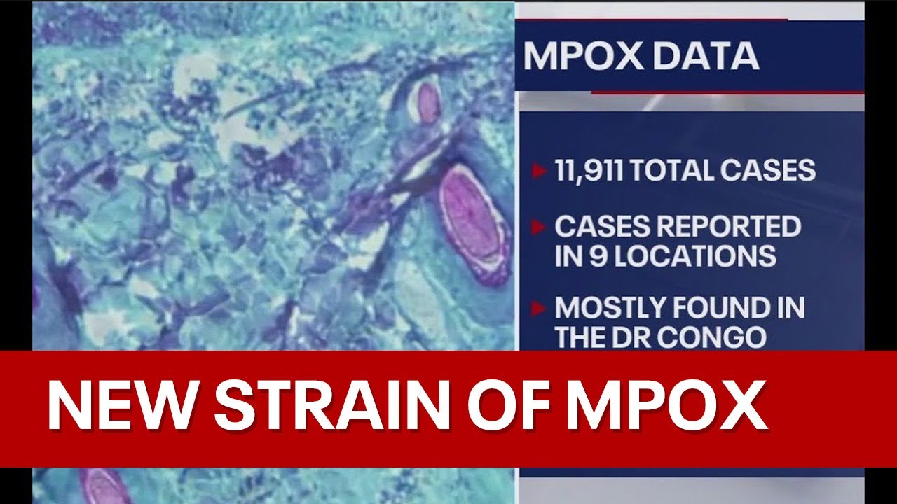 New strain of mpox found in California, first reported in US | KTVU ...