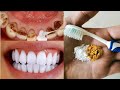 Bu Tarif Kirli Sarı Dişlerinizi Sadece 2 Dakikada İnci Gibi Parlatacak / Evde Doğal Diş Beyazlatma