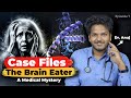 Medical Mystery : The Silent Predator in her Brain | Case Files Ep 7 | Dr. Anuj Pachhel