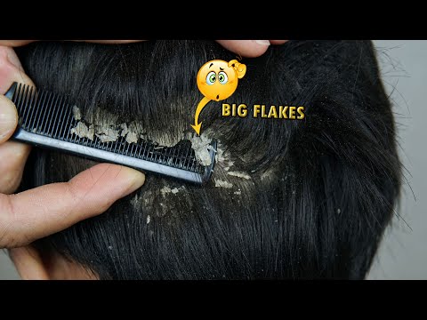 Video: Daft's Man Comb Je Slick Fix Pre šedé Vlasy