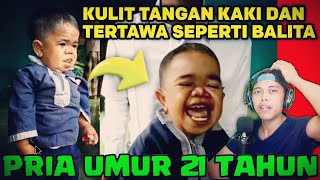 MUZAKIR pria 21 tahun dalam tubuh balita di NTB (REACTION)