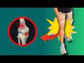 Como Resolver a Dor no Joelho ao Andar – Os Melhores Exercícios do Mundo