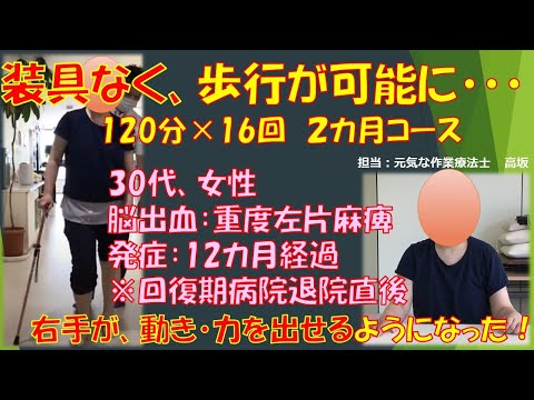 脳出血　重度左片麻痺　発症12カ月経過　回復期病院退院直後に120分×16回（2カ月コース）を実施。装具なく、歩行が可能となり、さらには左手（麻痺側）が、動き・力が出せるようになったご利用者様！！！