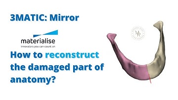 3matic : mirror - how to make symmetrical correction | تری متیک- اصلاحات تقارنی