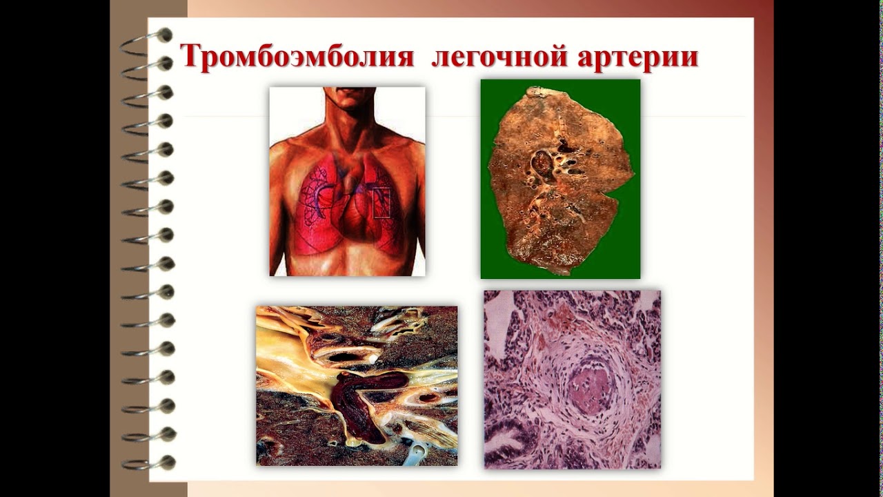 Моторные нарушения патофизиология