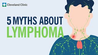 Debunking 5 Myths About Lymphoma