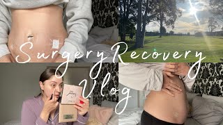 Endometriosis Surgery Number 2 Recovery