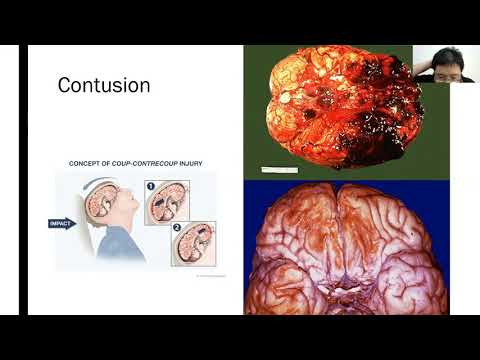 Pathology of the central nervous system part 2