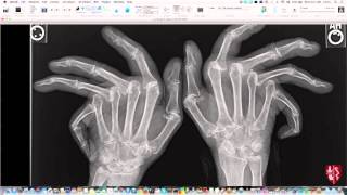 Introduction to Imaging of Arthritis