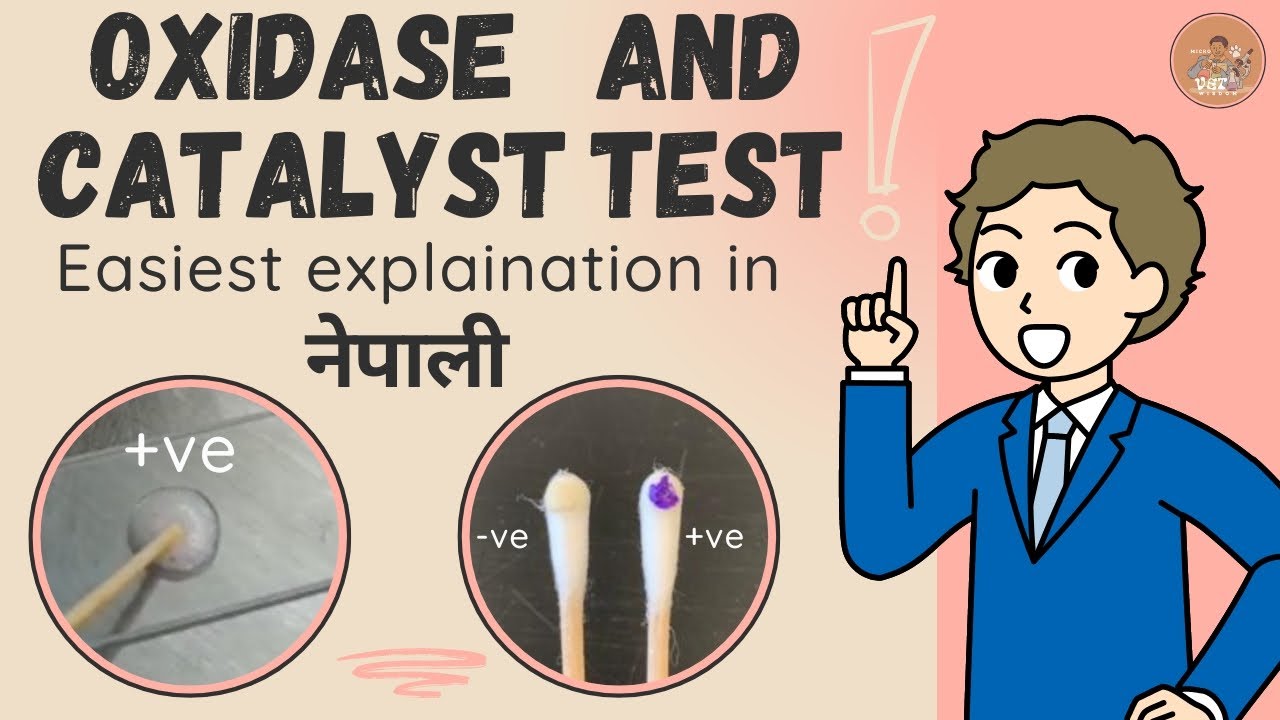 "How to Perform Catalase and Oxidase Tests: Step-by-Step Guide In ...