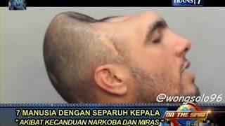 7 Manusia dengan Separuh Kepala & Keluarga pengoleksi Benda Aneh - On The Spot (Trans 7)