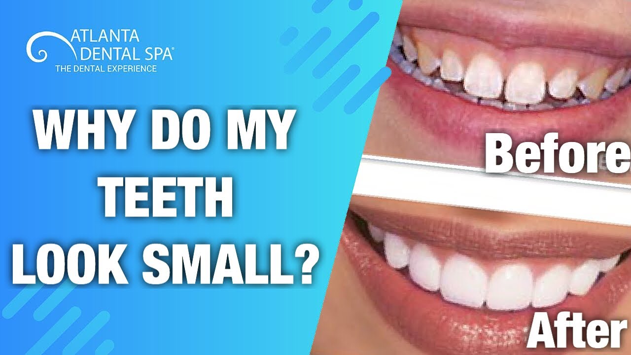 How To Fix Small Looking Teeth!