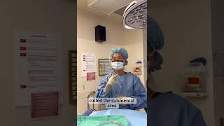 Submental Liposuction aka Double Chin Surgery