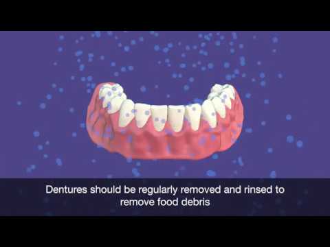 How To Clean a Denture Animation - Mouth Care Matters