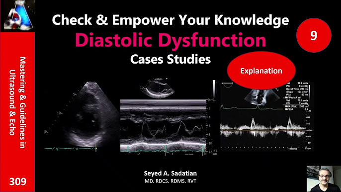 Diastolic dysfunction