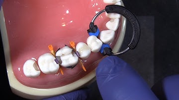 The Composi-Tight Soft Face 3D XR Ring from Garrison