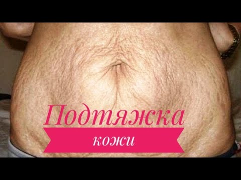 ПОДТЯЖКА КОЖИ после похудения и не только! - YouTube