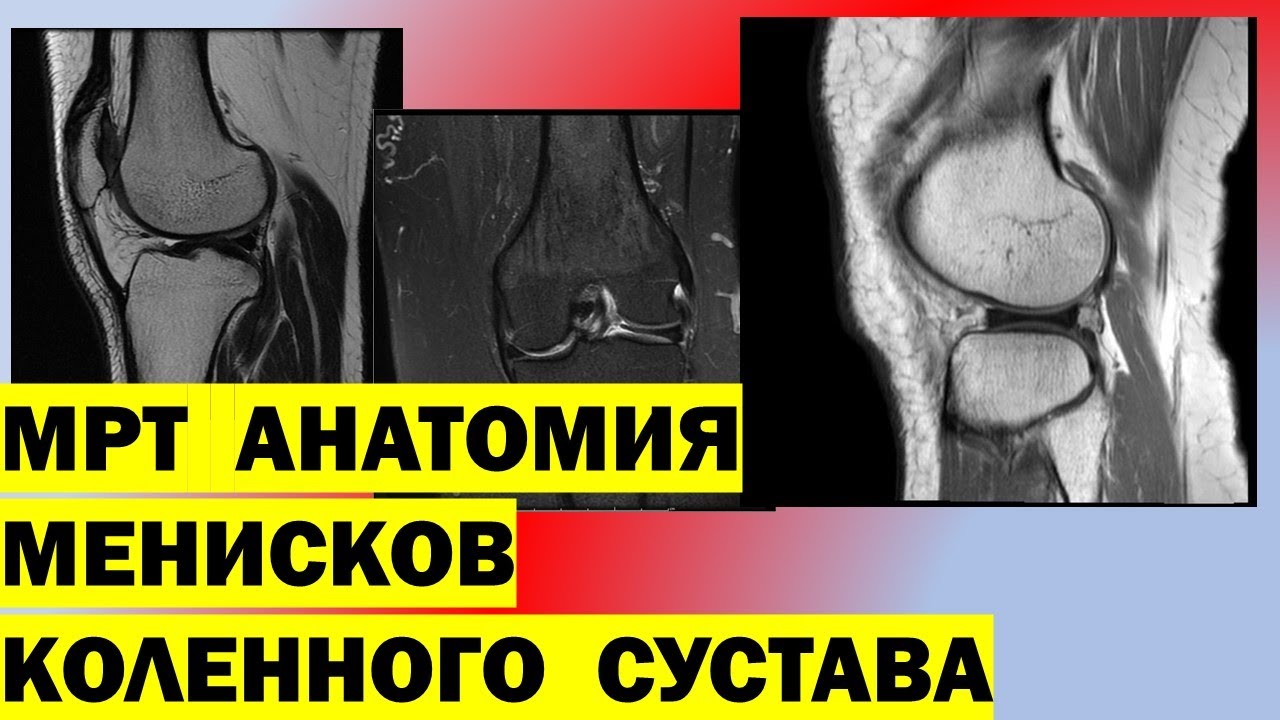 Опухоль коленного сустава после вывиха. Лечение После Эндопротезирования Коленного Сустава — Buy-artox.ru Вывих надколенника - KinesioPro Вывих коленного сустава — Physiotherapist