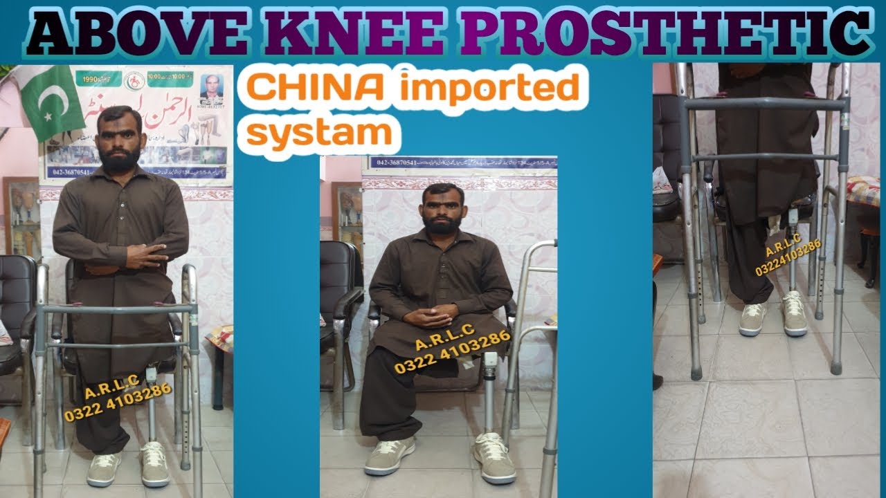 Above knee prosthesis 