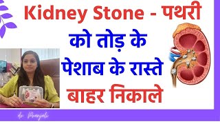 pathri ka ilaj | pathri ki dawai | pathri ke lakshan | kidney stone treatment homeopathy