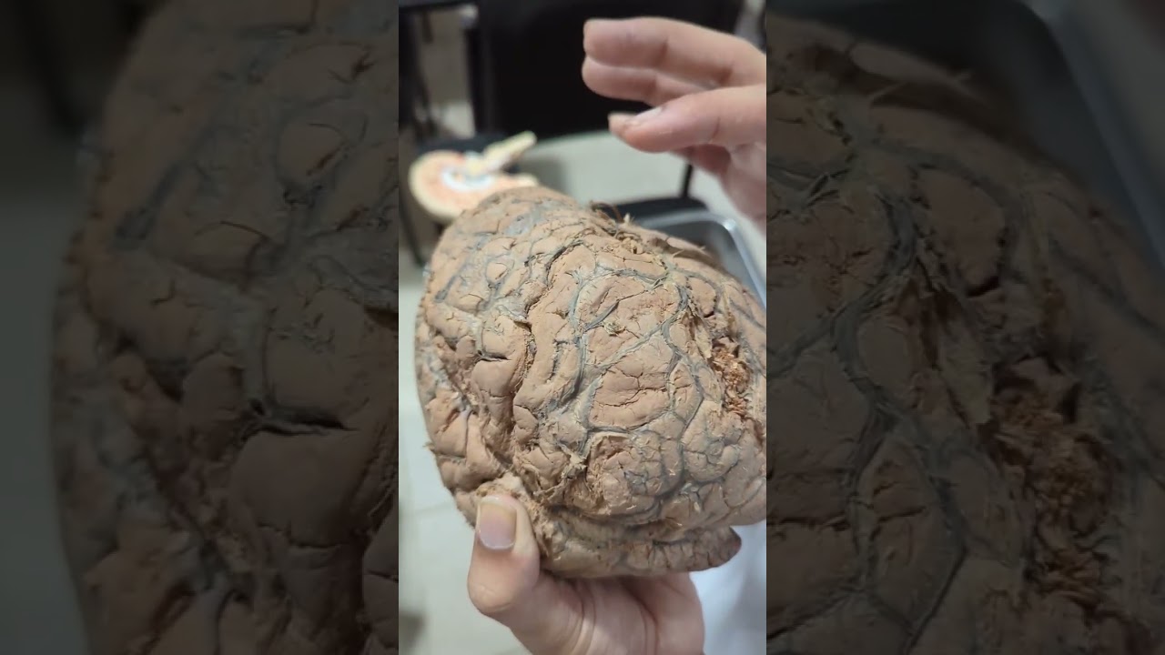 Cerebrum (General discussion) in Bangla( Part 1) 