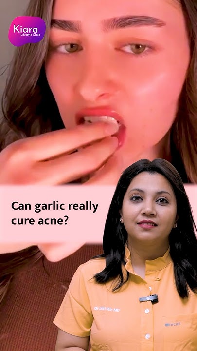 can-garlic-reduce-acne-garlic-for-acne-and-pimples-garlic-for-skin