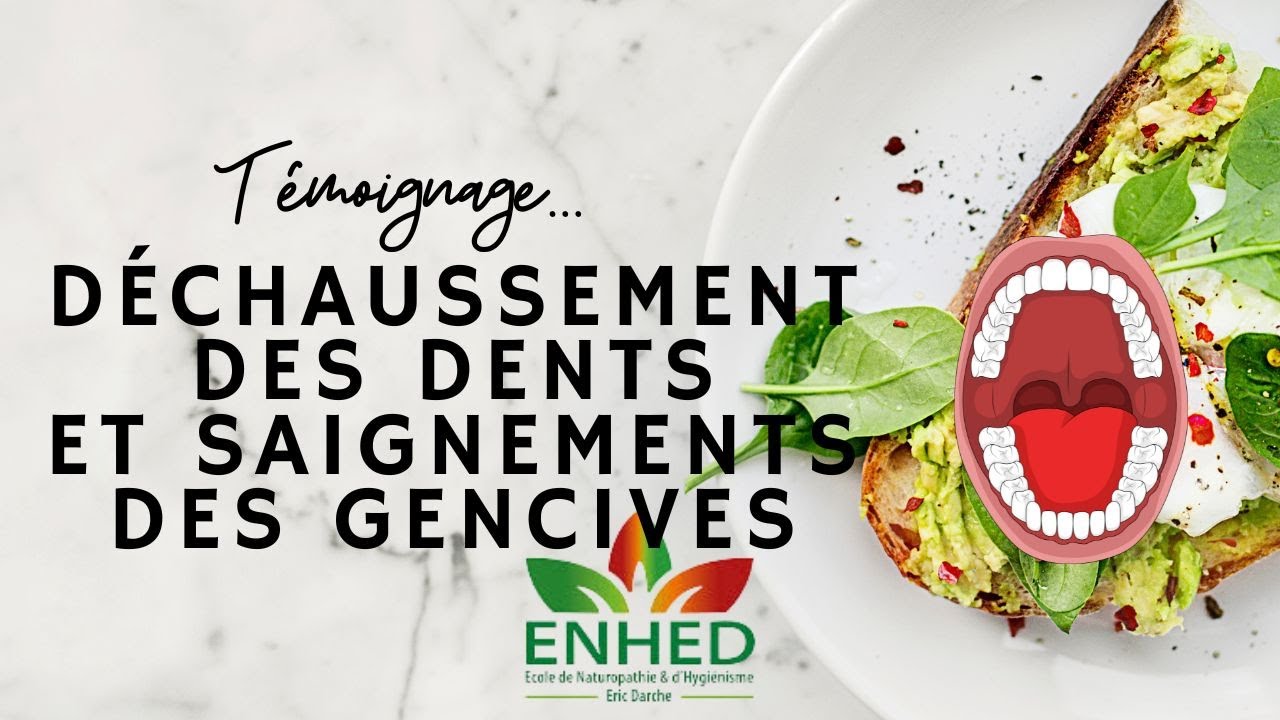 Témoignage : Déchaussement et saignements des dents