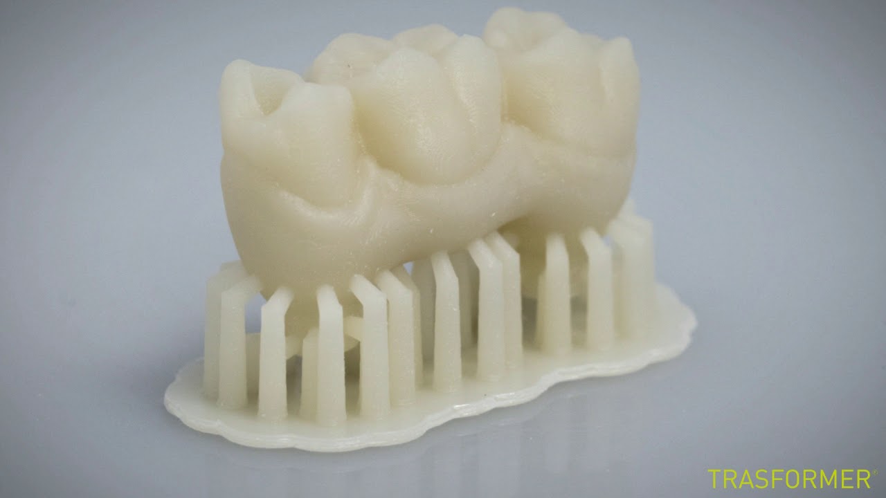 DIGITALE ANALOGICO NEL SETTORE DENTALE - STAMPA 3D